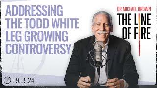 Dr. Brown Addresses the Todd White Leg Growing Controversy