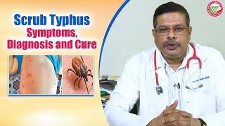 Scrub Typhus is preventable with awareness and prompt action.