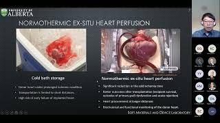 Elastomeric Materials & Embedded Sensors for Medical Devices & Smart Prosthetics | Chung Hyun Joong