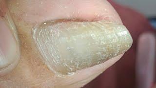 Neldz SOLO Parent  is live! Pedicure Today #satisfying