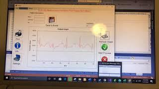 Excel Function ECG