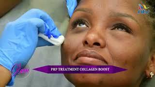 PRP treatment collagen boost | The Glam