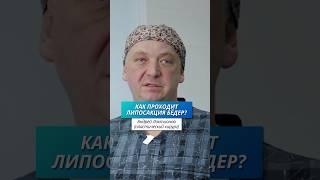 Как проводится липосакция бедер?