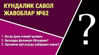 Кундалик саволларга жавоблар №62