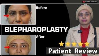 Blepharoplasty Surgery Experience   Happy Patient Testimonial