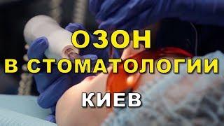 Озон в стоматологии (Киев)