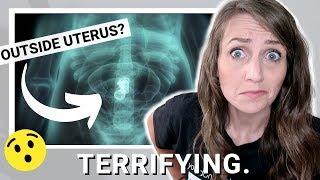 ObGyn Reacts: Baby Outside Womb!? | Strange Pregnancies by Real Families