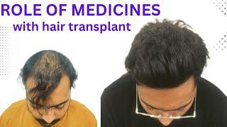 Hair transplant in indore | Role of medicines with hair transplant