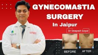 Gynecomastia Surgery In Jaipur | Rejuvena Cosmo Care - Dr Deepesh Goyal |