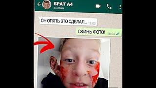 А4 оторвал ухо брату!!