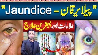 Jaundice Symptoms and Treatment - Jaundice Foods To Eat and Avoid - Pela Yarkan Ka ilaj