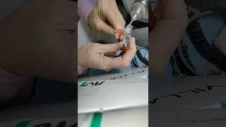 Шлифовка. Ортодонтия.  Видео готовой работы.