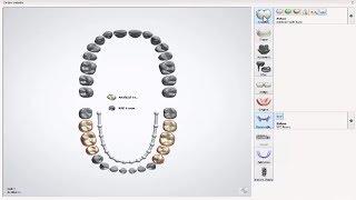 3Shape Dental System - RPD - Setup Order Form