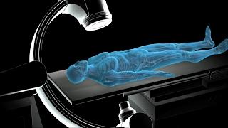 Non Cardiac Percutaneous Transluminal Angioplasty | NCPTA | Nucleus Health