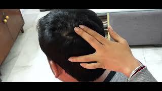 Scalp Scratching with Dandruff removal to sleep 