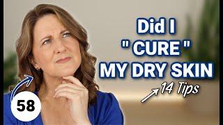 How I CURED my DRY SKIN (NOT SPONSORED)