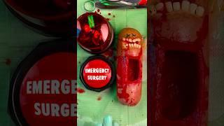 Emergency #FruitSurgery - The Button is Back! Giant Glizzy gives birth #FoodSurgery #DiscountDentist