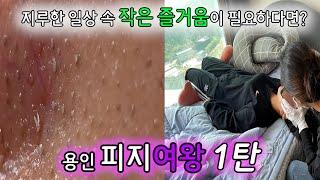 피지 직접 뽑아드렸습니다 -  피지계 왕족 계보를 잇는 용인사는 20대 생기발랄 피지여왕 1탄