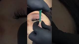 What is a dermal piercing? 