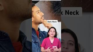 Acanthosis Nigricans Treatment | Reason of Black Neck | How to Treat Black Neck | Dr. Sridevi