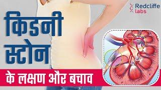 किडनी स्टोन के लक्षण और बचाव | Kidney Stone Early Symptoms And Prevention in Hindi