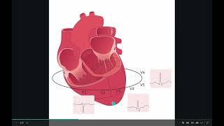 ECG R wave progression in a nutshell (including case discussion)