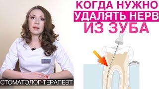 Лечение каналов зуба - в каких случаях делать? Перепломбировка каналов зуба, пульпит, периодонтит.