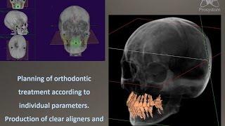 Diagnostics and planning of treatment in virtual space