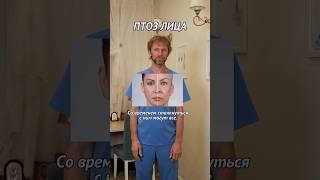 Птоз лица. Что делать? #здоровье #лицо #красота #остеопатия #остеопат #shortsvideo #shorts
