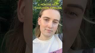 6 Months HRT MTF Transition Timeline #transgender #transgirl #transition