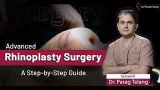 Advanced Rhinoplasty Surgery by Plastic Surgeon Dr. Parag Telang | Best Plastic Surgeon in Mumbai