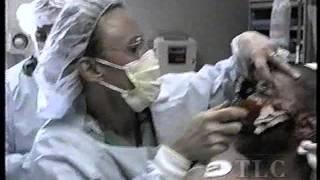 SHOT IN FACE BY POLICE - emergency room hospital ambulance surgical procedure reality tv live act ER