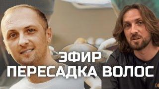 ПЕРЕСАДКА ВОЛОС РАЗВОД? ОТВЕЧАЕМ НА ВОПРОСЫ