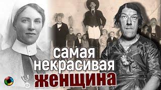 Красавица и чудовище... История самой уродливой женщины в мире