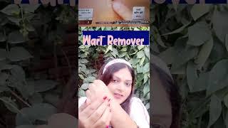 What is a wart removal cream? Massa removal at home | Wart Remover |