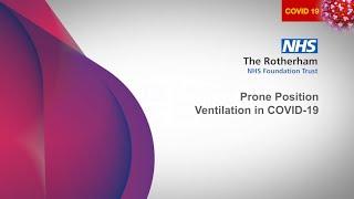 Prone position ventilation COVID 19