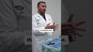 Laparoscopic Instruments - Dissectors #meded #surgtech #surgicaltechnologist #surgery #laparoscopic