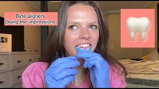 Watch this before buying Byte Aligners (discount code)