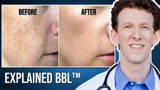 What is the Forever Young BBL Treatment?