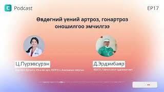 Өвдөгний үений артроз, гонартрозын оношилгоо, эмчилгээ