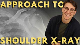 Shoulder X-ray interpretation | How to read a trauma shoulder X-ray