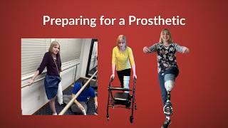 Preparing for the First Prosthetic Leg After Amputation