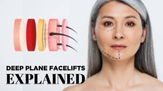 What is a Deep Plane Facelift? | Dr. Greg Bran