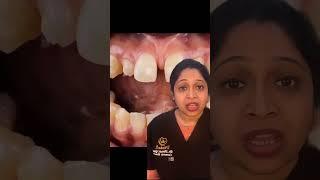 Watch this video before you get gaps in your teeth corrected.