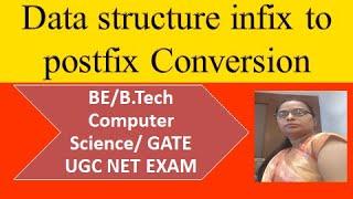 Data structure infix to postfix conversion#datastructure#infixtopostfix