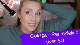 Don't Miss This Skincare Step in Your Over 50 Routine | Collagen Remodeling