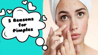 5 Major Resons for pimples ||skin care||Removal of pimples||Tipsify #pimples #PimpleReasons