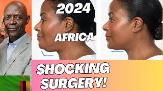 PLASTIC SURGERY IS NOW IN ZAMBIA IN 2025