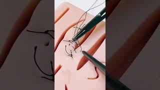 СКОЛЬКО ДЛЯТСЯ ХИРУРГИЧЕСКИЕ ОПЕРАЦИИ | SCALPEL.MED #shorts