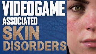 Videogame-Associated Skin Disorders: A Doctor's Guide